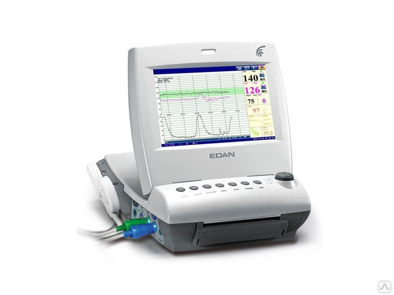 Авк 1. Монитор фетальный "Овертон 6900". Монитор фетальный Edan f6. Фетальный монитор comen Star 5000 f.
